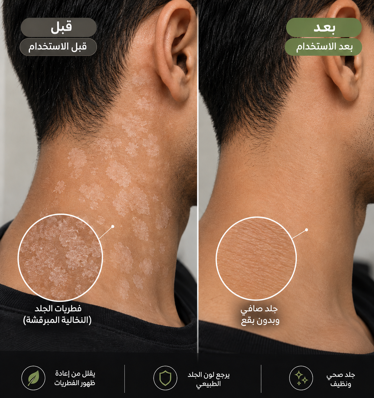 قبل وبعد الرقبة