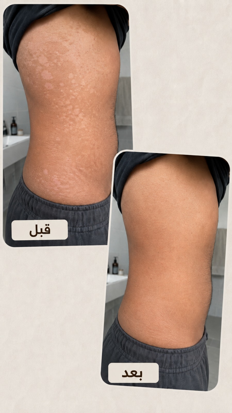 صورة قبل وبعد 1