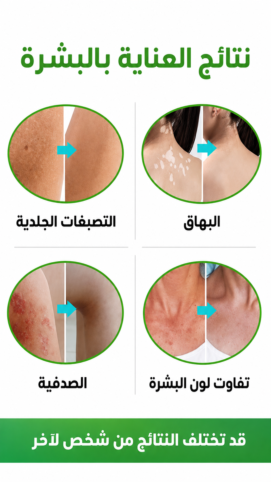 طريقة استخدام الكريم