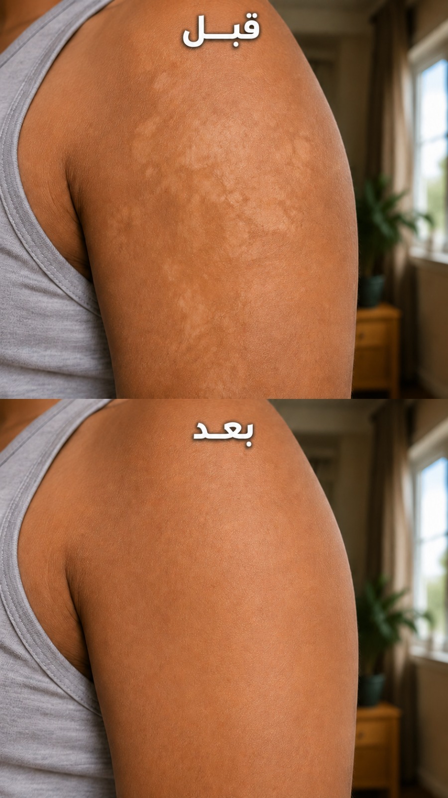 قبل وبعد الكتف